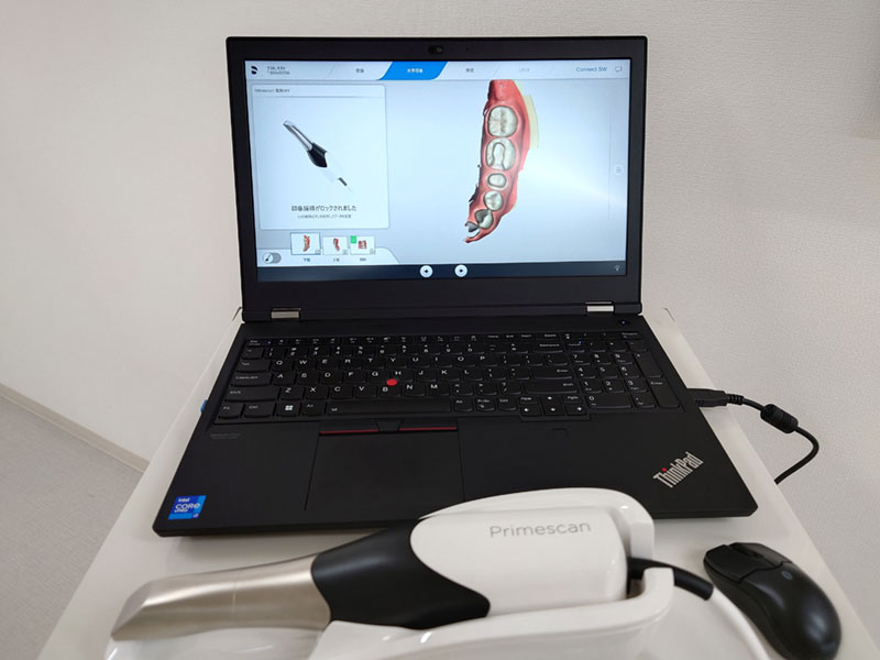口腔内スキャナー写真