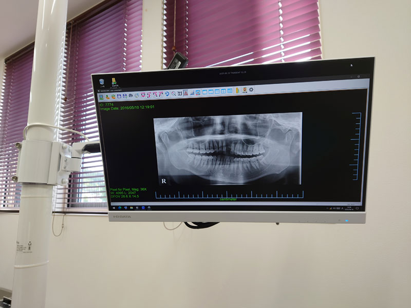 チェアーモニター写真